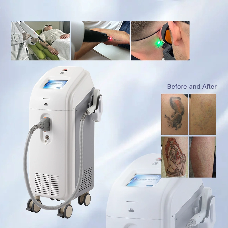 Long Life High Quality Tattoo Oat Removal Qswitched ND YAG Q-Switched Laser Machine